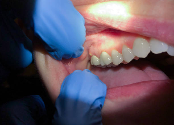 Best Emergency Broken Tooth Repair in Red Bank, TN